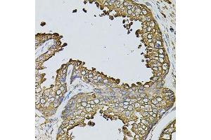 Immunohistochemistry of paraffin-embedded human prostate using MYL1 antibody. (MYL1 Antikörper  (AA 1-150))