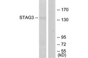 Western blot analysis of extracts from Jurkat cells, using STAG3 Antibody. (STAG3 Antikörper  (AA 1161-1210))
