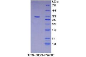 SDS-PAGE analysis of Mouse Meprin A alpha Protein.