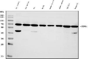 Western blot analysis of PRDM14 using anti-PRDM14 antibody (ABIN7603152). (PRDM14 Antikörper  (N-Term))