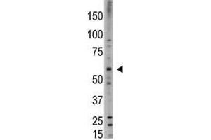 Image no. 1 for anti-Bone Morphogenetic Protein 6 (BMP6) (N-Term) antibody (ABIN357184) (BMP6 Antikörper  (N-Term))
