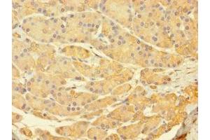 Immunohistochemistry of paraffin-embedded human pancreatic tissue using ABIN7174731 at dilution of 1:100 (PARP11 Antikörper  (AA 1-245))