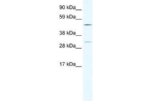 WB Suggested Anti-CAMK4 Antibody Titration:  2. (CAMK4 Antikörper  (C-Term))