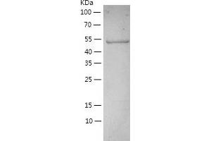 RNA Guanine-7 Methyltransferase (RNMT) (AA 1-476) protein (His-IF2DI Tag)