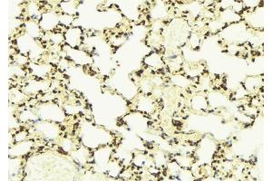 ABIN6276573 at 1/100 staining Mouse lung tissue by IHC-P. (PYCARD Antikörper  (N-Term))