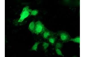 Anti-PNMT mouse monoclonal antibody (ABIN2454539) immunofluorescent staining of COS7 cells transiently transfected by pCMV6-ENTRY PNMT (RC206586). (PNMT Antikörper)