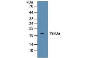 Cofilin Antikörper  (AA 3-161)