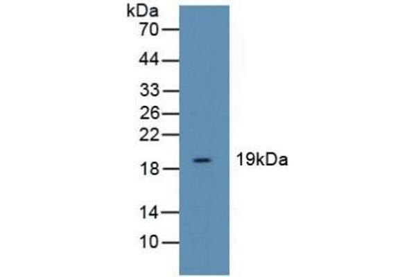 Cofilin Antikörper  (AA 3-161)