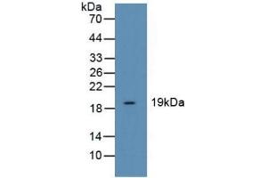 Cofilin antibody  (AA 3-161)