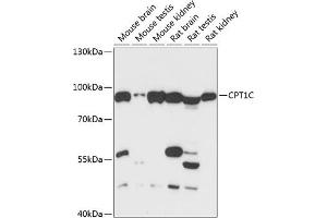Western blot analysis of extracts of various cell lines, using CPT1C antibody (ABIN6130131, ABIN6138980, ABIN6138981 and ABIN6217987) at 1:3000 dilution. (CPT1C Antikörper  (AA 270-400))