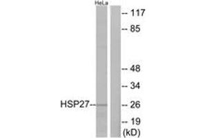 Western blot analysis of extracts from HeLa cells, treated with Ca2+, using HSP27 (Ab-82) Antibody. (HSP27 Antikörper  (AA 48-97))