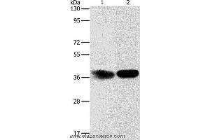 Western blot analysis of Hela cell and mouse kidney tissue, using ADPRHL2 Polyclonal Antibody at dilution of 1:500 (ADPRHL2 Antikörper)