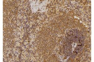 ABIN6258774 and ABIN6274538 at 1/100 staining Rat spleen tissue by IHC-P. (EPH Receptor A6 Antikörper  (C-Term))