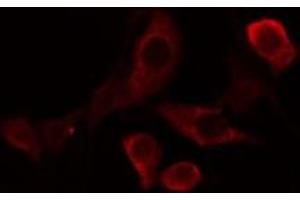 ABIN6275810 staining Hela cells by IF/ICC.