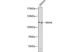 Western blot analysis of extracts of SKOV3 cells using MSH4 Polyclonal Antibody at dilution of 1:1000. (MSH4 Antikörper)