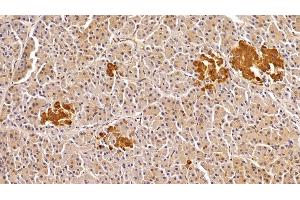 Immunohistochemistry (IHC) image for anti-TAR DNA Binding Protein (TARDBP) (AA 104-262) antibody (ABIN7434404)