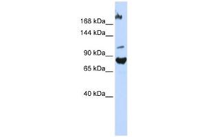 FBXO11 antibody used at 1 ug/ml to detect target protein. (FBXO11 Antikörper  (Middle Region))