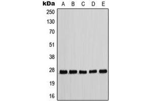 Western blot analysis of p27 Kip1 (pT198) expression in HEK293T EGF-treated (A), MCF7 (B), NIH3T3 (C), Raw264. (CDKN1B Antikörper  (C-Term, pSer198))