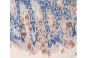 IHC-P analysis of Mouse Tissue, with DAB staining. (ACAT1 Antikörper  (AA 31-424))
