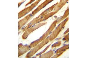 SLC16A10 Antibody (C-term) (ABIN657159 and ABIN2846293) immunohistochemistry analysis in formalin fixed and paraffin embedded human skeletal muscle followed by peroxidase conjugation of the secondary antibody and DAB staining. (SLC16A10 Antikörper  (C-Term))