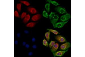 ABIN6260213 and ABIN6273093 staining Hela cells by IF/ICC. (BBS7 Antikörper  (Internal Region))