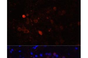 Immunofluorescence analysis of Mouse brain using CALB2 Polyclonal Antibody at dilution of 1:100. (Calretinin Antikörper)