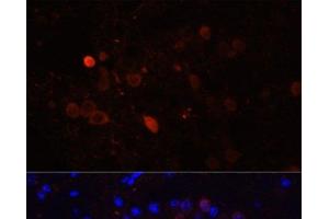 Immunofluorescence analysis of Mouse brain using CALB2 Polyclonal Antibody at dilution of 1:100. (Calretinin Antikörper)