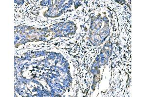 IHC analysis of ATG16L1 using anti-ATG16L1 antibody (ABIN7602244). (ATG16L1 Antikörper  (AA 66-359))