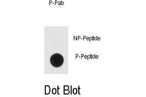 Image no. 1 for anti-Enolase 2 (Gamma, Neuronal) (ENO2) (pTyr236) antibody (ABIN358515) (ENO2/NSE Antikörper  (pTyr236))