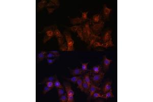 Immunohistochemistry of paraffin-embedded rat heart using Dystrophin Rabbit pAb (ABIN1679546, ABIN3015473, ABIN3015474 and ABIN6218357) at dilution of 1:25 (40x lens). (Dystrophin Antikörper  (AA 346-635))