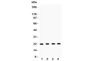 Western blot testing of Securin antibody and Lane 1:  HeLa (PTTG1 Antikörper  (AA 146-161))