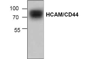 Image no. 1 for anti-CD44 (CD44) antibody (ABIN155127) (CD44 Antikörper)