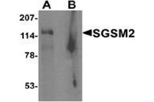 Western blot analysis of SGSM2 in human cerebellum tissue lysate with SGSM2 Antibody  at 1 μg/ml in (A) the absence and (B) the presence of blocking peptide (SGSM2 Antikörper  (Middle Region))