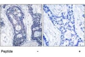 Image no. 1 for anti-Eukaryotic Translation Initiation Factor 4E (EIF4E) (Ser209) antibody (ABIN197473) (EIF4E Antikörper  (Ser209))