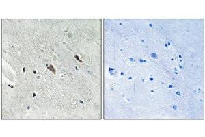 Immunohistochemical analysis of paraffin-embedded human brain tissue using Gab2 (Phospho-Tyr643) antibody (left)or the same antibody preincubated with blocking peptide (right). (GAB2 Antikörper  (pTyr643))