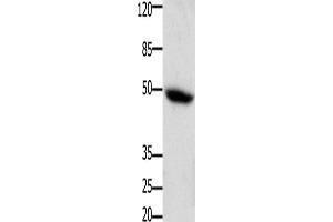 Western Blotting (WB) image for anti-Colony Stimulating Factor 2 Receptor, Alpha, Low-Affinity (Granulocyte-Macrophage) (CSF2RA) antibody (ABIN2826100)
