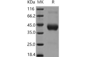 Western Blotting (WB) image for Fc Fragment of IgG, High Affinity Ia, Receptor (CD64) (FCGR1A) (Active) protein (His tag) (ABIN7195675)
