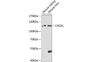 Western blot analysis of extracts of various cell lines, using CHD1L antibody (ABIN7266362) at 1:1000 dilution. (CHD1L Antikörper  (AA 320-570))