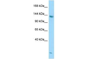 WB Suggested Anti-STAG2 Antibody Titration: 1. (STAG2 Antikörper  (C-Term))