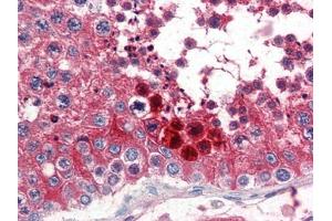 Human Testis (formalin-fixed, paraffin-embedded) stained with CLUat 2. (Clusterin Antikörper  (C-Term))