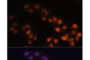 Immunofluorescence analysis of HeLa cells using WT1 Polyclonal Antibody at dilution of 1:100. (WT1 Antikörper)