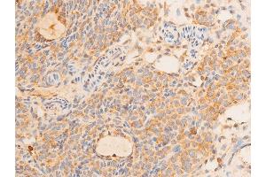 ABIN6256817 and ABIN6267232 at 1/100 staining rat ovarian tissue sections by IHC-P. (Tumor Protein p73 Antikörper  (pTyr99))