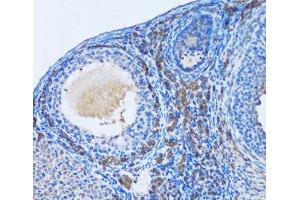 Immunohistochemistry of paraffin-embedded Rat ovary using OGDH Polyclonal Antibody at dilution of 1:100 (20x lens).