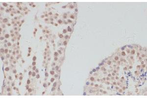 Immunohistochemistry of paraffin-embedded Mouse testis using CCNG1 Polyclonal Antibody at dilution of 1:100 (40x lens). (Cyclin G1 Antikörper)