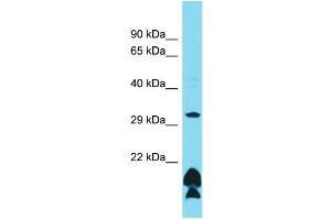 Host: Rabbit Target Name: OR51B5 Sample Type: HCT15 Whole Cell lysates Antibody Dilution: 1. (OR51B5 Antikörper  (C-Term))