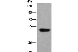 Western blot analysis of Human fetal liver tissue lysate using HNRNPH2 Polyclonal Antibody at dilution of 1:400