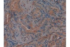 Used in DAB staining on fromalin fixed paraffin-embedded Kidney tissue (PAI1 Antikörper  (AA 25-402))