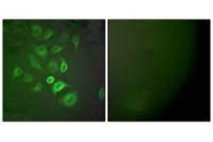 Immunofluorescence analysis of A549 cells, using S100 A1 antibody. (S1A1 Antikörper)