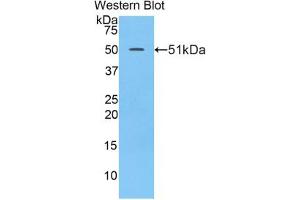 Western blot analysis of the recombinant protein. (LAMC2 Antikörper  (AA 972-1191))