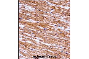 Mouse Nek6 Antibody (C-term) ((ABIN657847 and ABIN2846808))immunohistochemistry analysis in formalin fixed and paraffin embedded mouse heart tissue followed by peroxidase conjugation of the secondary antibody and DAB staining. (NEK6 Antikörper  (C-Term))